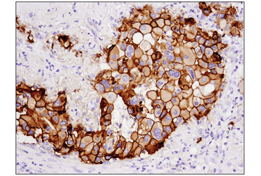 Immunohistochemistry Image 2: Tissue Factor/CD142 (E9M6T) XP<sup>®</sup> Rabbit mAb