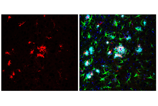 Immunofluorescence Image 2: p22phox (E7Y1F) XP<sup>®</sup> Rabbit mAb