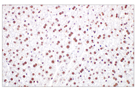 Immunohistochemistry Image 6: Ezh2 (D2C9) XP<sup>®</sup> Rabbit mAb (BSA and Azide Free)