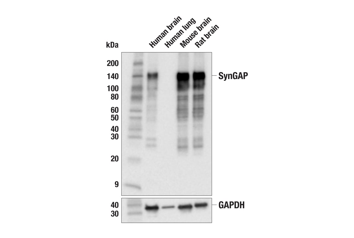 Western Blotting Image 1: SynGAP (E7J9K) Mouse mAb