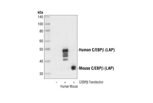 undefined Image 5: C/EBP Antibody Sampler Kit