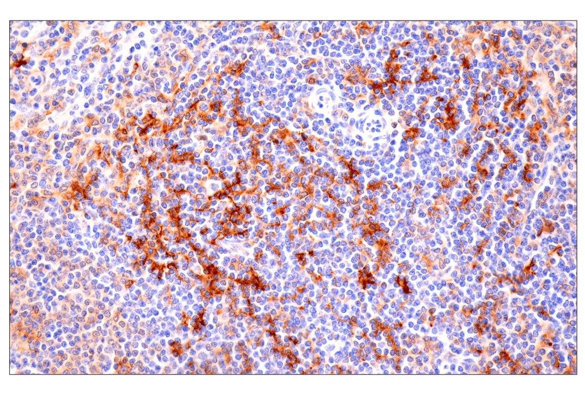 Immunohistochemistry Image 2: CD86 (E2G8P) Rabbit mAb