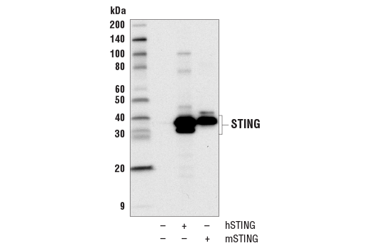 Western Blotting Image 1: STING (D2P2F) Rabbit mAb (BSA and Azide Free)