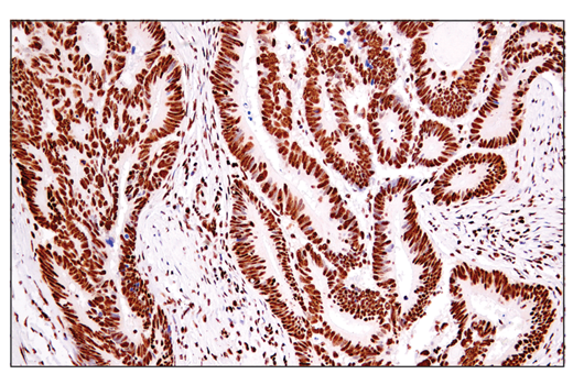 Immunohistochemistry Image 2: ADAR1 (E6X9R) XP<sup>®</sup> Rabbit mAb