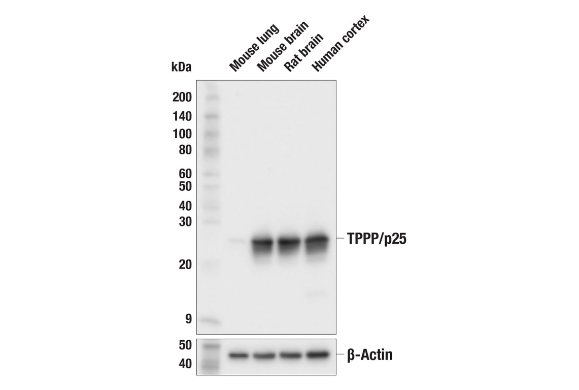 Western Blotting Image 1: TPPP/p25 (E7F8S) Rabbit mAb