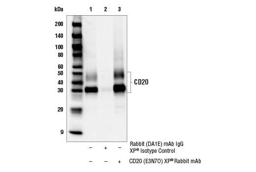 Immunoprecipitation Image 1: CD20 (E3N7O) XP<sup>®</sup> Rabbit mAb