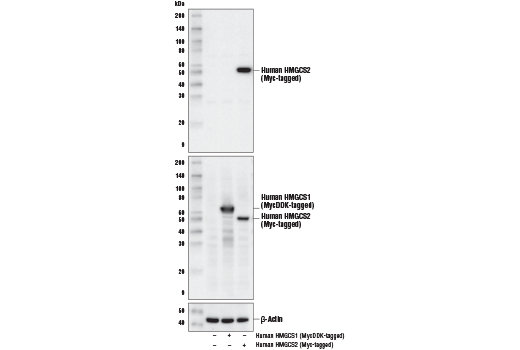 Western Blotting Image 1: HMGCS2 (D8B5M) Rabbit mAb
