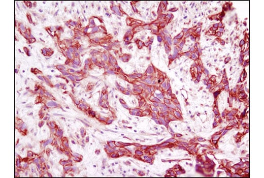 Immunohistochemistry Image 1: Annexin A2 (D11G2) Rabbit mAb