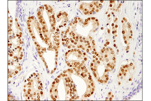 Immunohistochemistry Image 3: NKX3.1 (D6D2Z) XP<sup>®</sup> Rabbit mAb