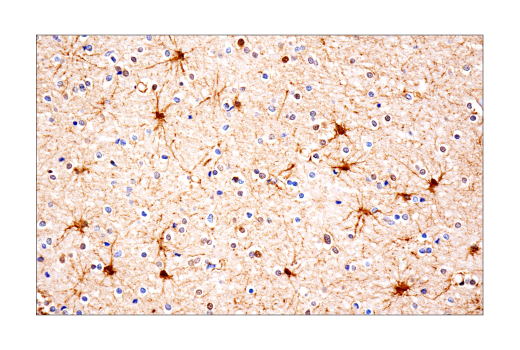 Immunohistochemistry Image 1: S100A1 (4C4.9) Mouse mAb