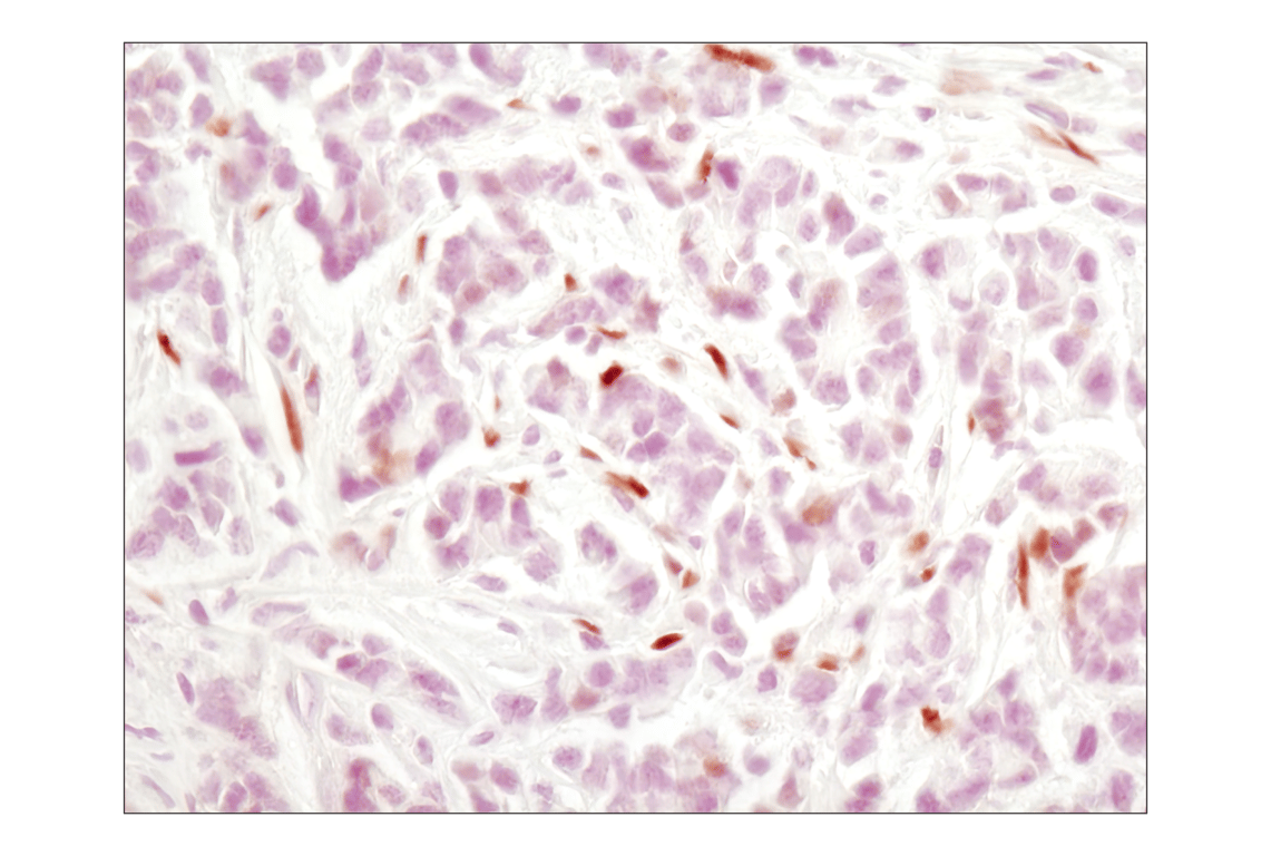 Immunohistochemistry Image 1: Phospho-Stat3 (Tyr705) (M9C6) Mouse mAb