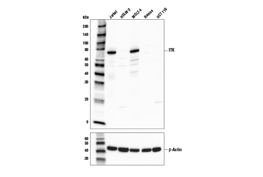 Western Blotting Image 1: ITK (E4X7M) Rabbit mAb (Biotinylated)