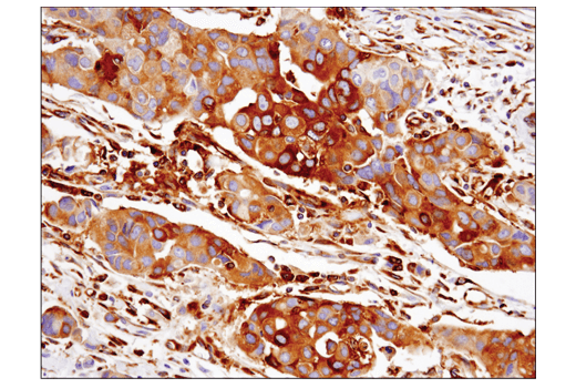 Immunohistochemistry Image 1: IFIT1 (D2X9Z) Rabbit mAb