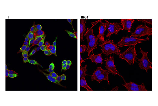 Immunofluorescence Image 1: CGRP (D5R8F) Rabbit mAb (BSA and Azide Free)