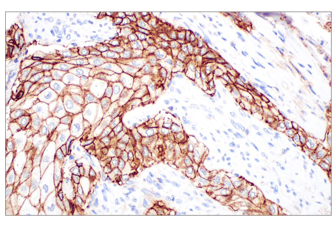 Immunohistochemistry Image 2: CD44 v5 (C44Mab-3) Mouse mAb