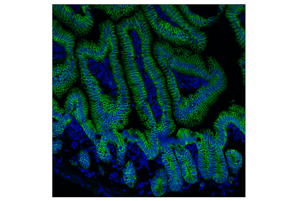 undefined Image 9: Cadherin-Catenin Antibody Sampler Kit