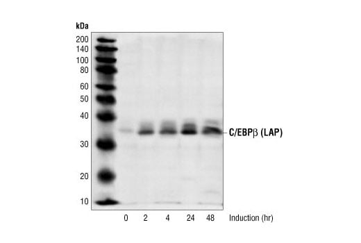 undefined Image 11: C/EBP Antibody Sampler Kit