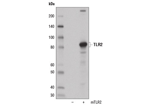 Western Blotting Image 2: Toll-like Receptor 2 (E1J2W) Rabbit mAb