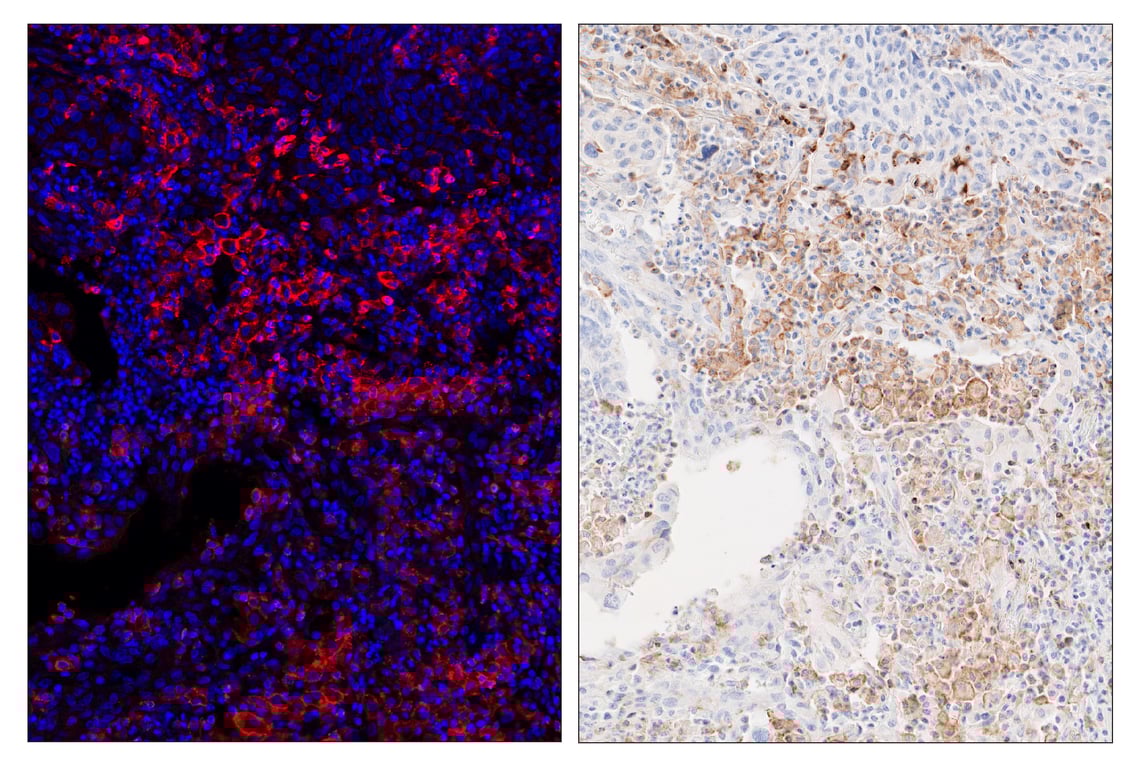 Immunohistochemistry Image 6: TIM-3 (D5D5R<sup>™</sup>) & CO-0010-647 SignalStar<sup>™</sup> Oligo-Antibody Pair