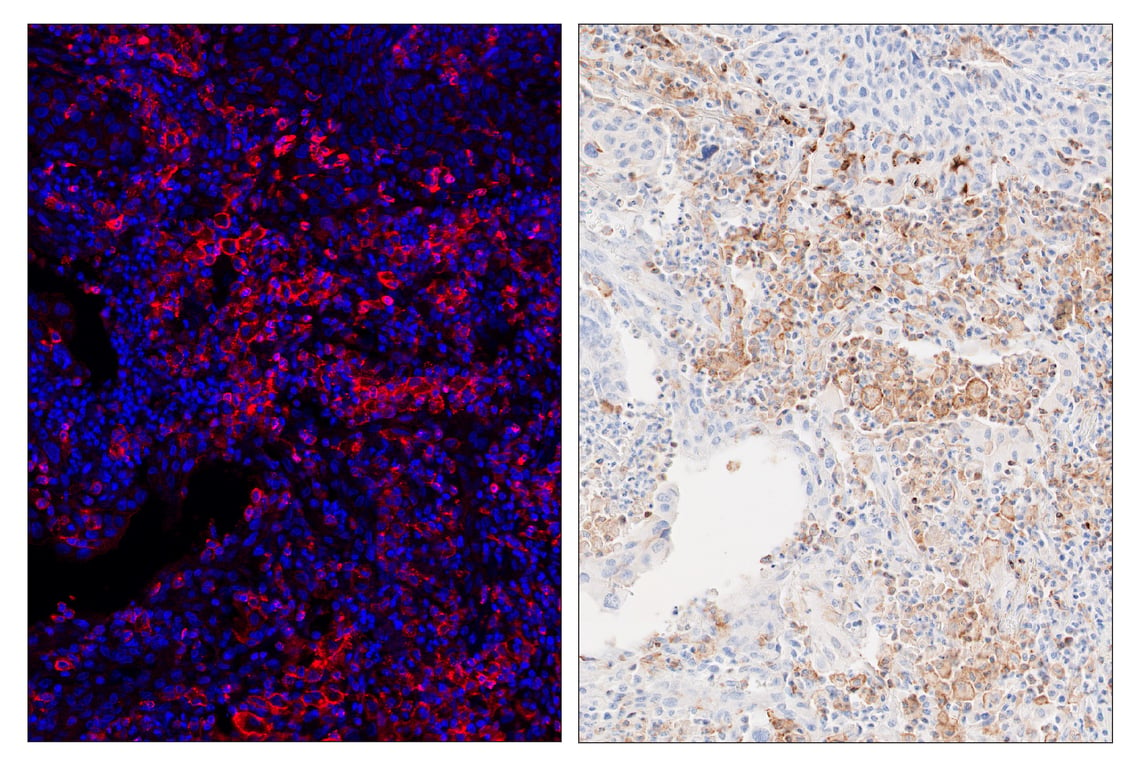 Immunohistochemistry Image 6: TIM-3 (D5D5R<sup>™</sup>) & CO-0010-750 SignalStar<sup>™</sup> Oligo-Antibody Pair