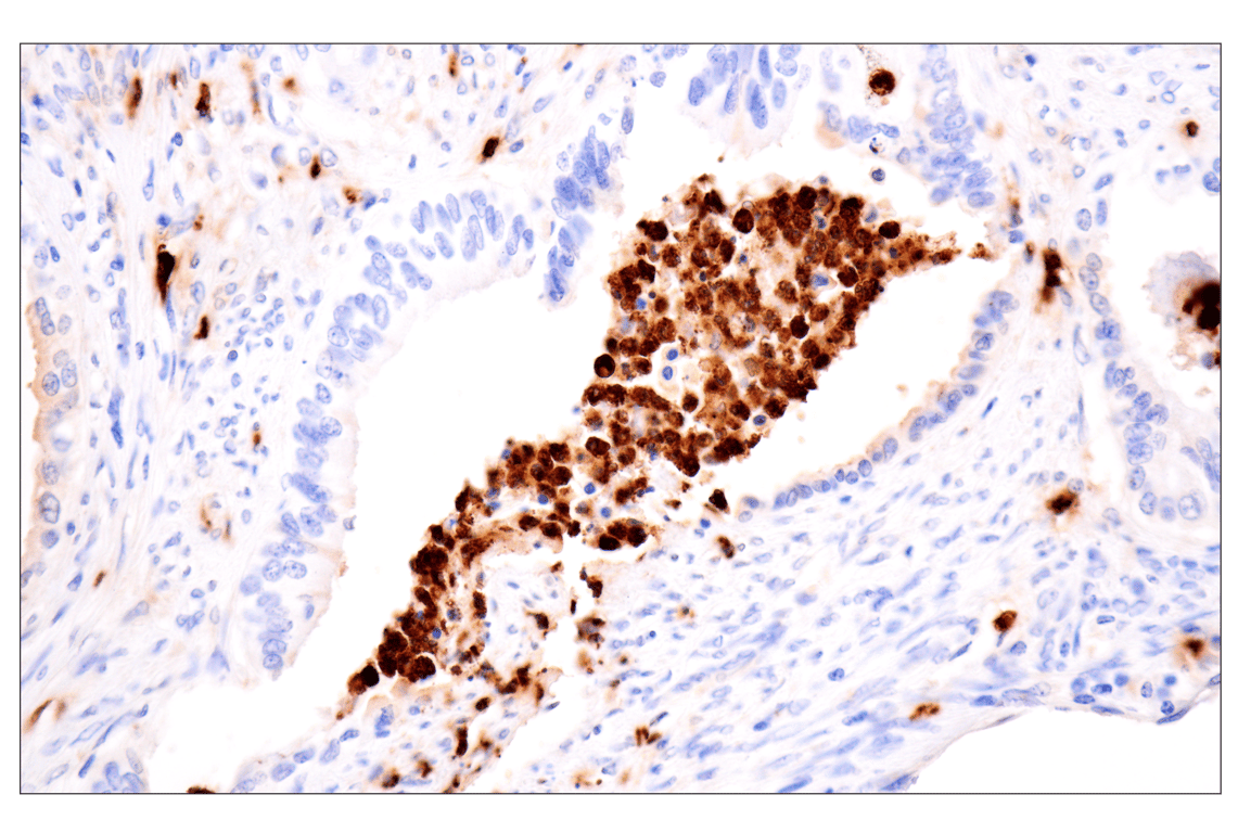 Immunohistochemistry Image 2: Neutrophil Elastase (F4H3X) Rabbit mAb (BSA and Azide Free)