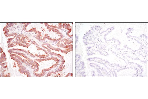 Immunohistochemistry Image 4: RSK2 (D21B2) XP<sup>®</sup> Rabbit mAb (BSA and Azide Free)