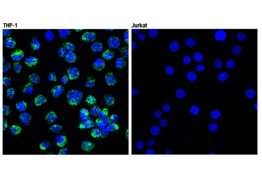 undefined Image 57: Microglia Neurodegeneration Module Antibody Sampler Kit