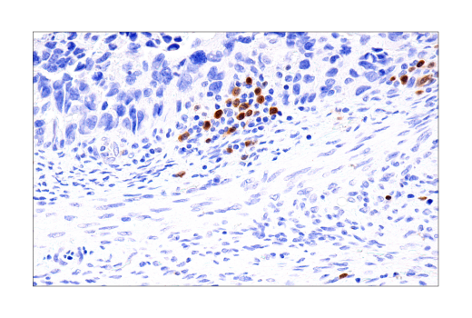 Immunohistochemistry Image 5: BOB-1/OBF-1 (E5K1D) Rabbit mAb (BSA and Azide Free)