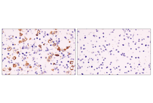 Immunohistochemistry Image 7: CD141/Thrombomodulin (E7Y9P) XP<sup>®</sup> Rabbit mAb (BSA and Azide Free)