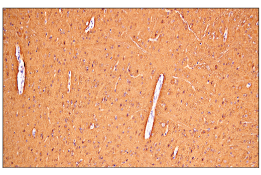 Immunohistochemistry Image 5: Enolase-2 (E2H9X) XP<sup>®</sup> Rabbit mAb