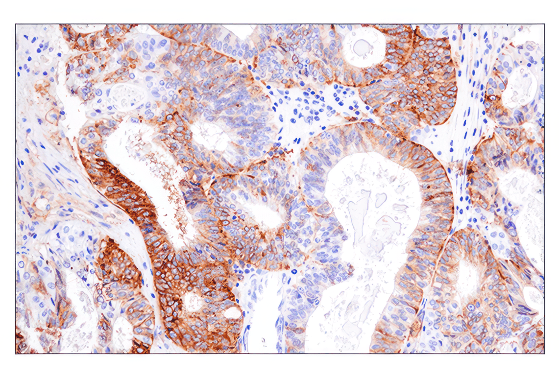 Immunohistochemistry Image 2: HLA-DRA (E9R2Q) XP<sup>®</sup> Rabbit mAb