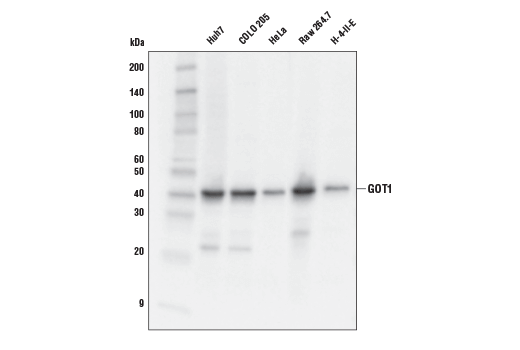 undefined Image 2: Glutamine Metabolism Antibody Sampler Kit