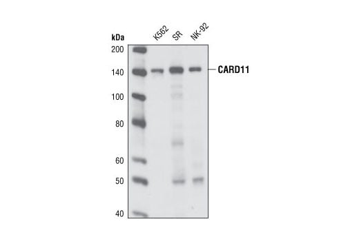 Western Blotting Image 1: CARD11 (1D12) Rabbit mAb