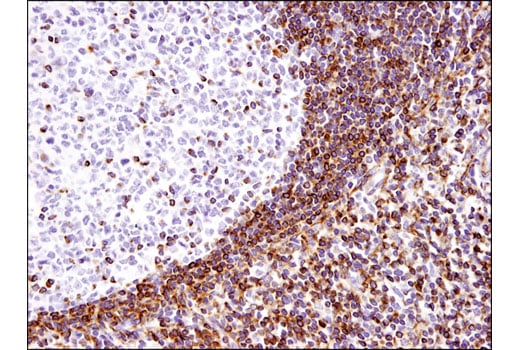 Immunohistochemistry Image 4: Bcl-2 (124) Mouse mAb