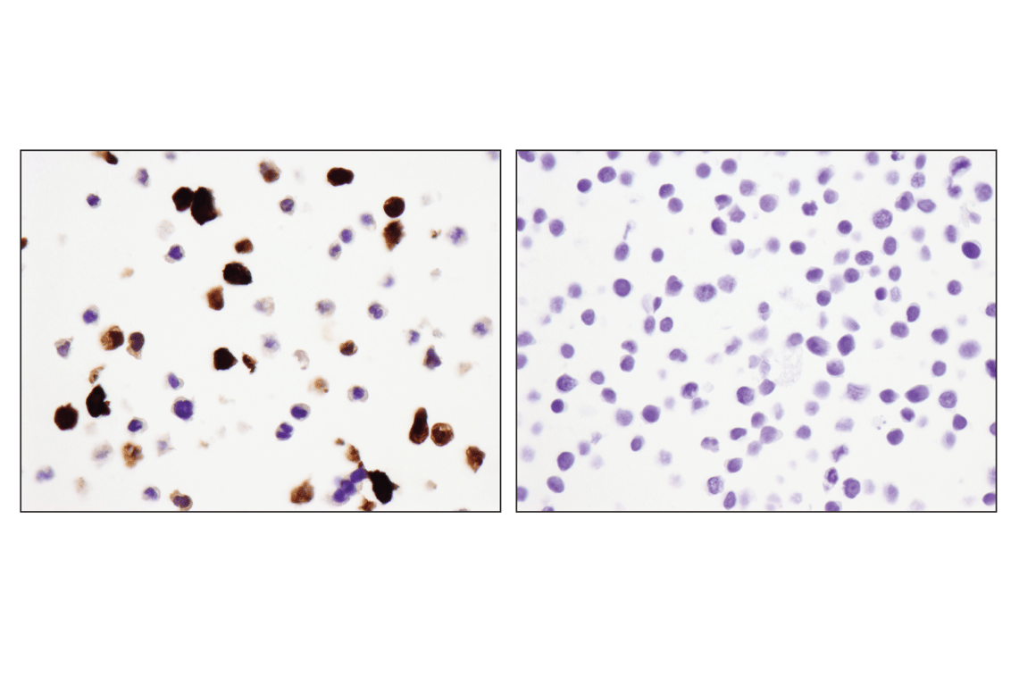 Immunohistochemistry Image 5: S100A9 (D5O6O) Rabbit mAb (BSA and Azide Free)