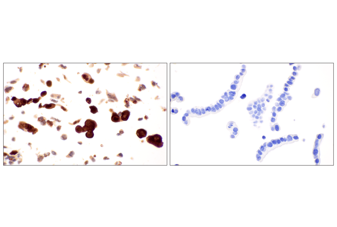 Immunohistochemistry Image 15: MTAP (E5R1I) Rabbit mAb (BSA and Azide Free)