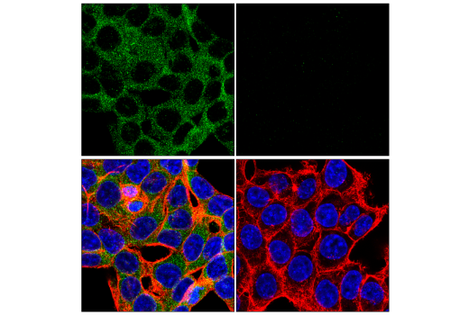 Immunofluorescence Image 1: ROCK2 (E5T5P) Rabbit mAb