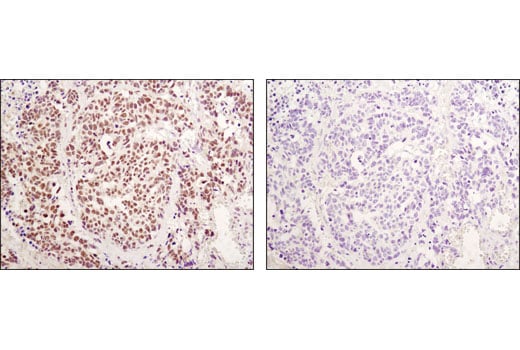 Immunohistochemistry Image 2: RBPSUH (D10A4) XP<sup>®</sup> Rabbit mAb