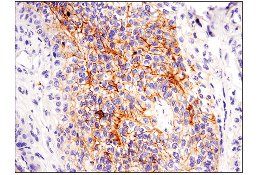 Immunohistochemistry Image 1: c-Kit (D3W6Y) XP<sup>®</sup> Rabbit mAb