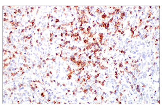 Immunohistochemistry Image 1: CD7 (E4G1Q) XP<sup>®</sup> Rabbit mAb