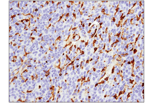 Immunohistochemistry Image 1: VISTA (D5L5T) XP<sup>®</sup> Rabbit mAb