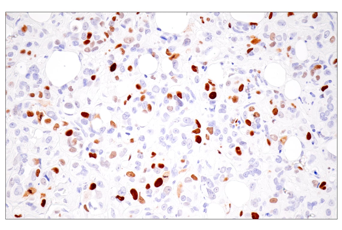 Immunohistochemistry Image 8: UHRF1 (E5W8W) Rabbit mAb