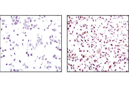 undefined Image 1: SignalSlide<sup>®</sup> PTEN IHC Controls