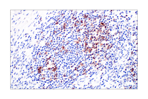 undefined Image 59: Human Exhausted CD8<sup>+</sup> T Cell IHC Antibody Sampler Kit