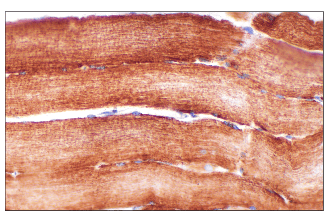 undefined Image 44: Cell Fractionation Antibody Sampler Kit