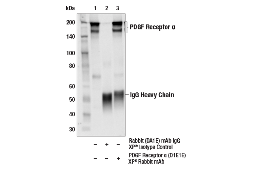 Immunoprecipitation Image 1: PDGF Receptor α (D1E1E) XP<sup>®</sup> Rabbit mAb