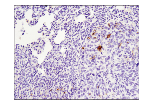 Immunohistochemistry Image 3: PD-L1 (D5V3B) Rabbit mAb
