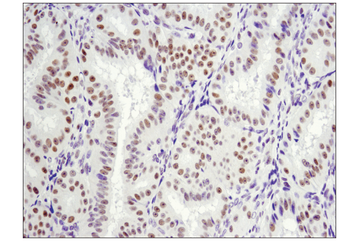 Immunohistochemistry Image 3: LRF/Pokemon (D7U2O) Rabbit mAb