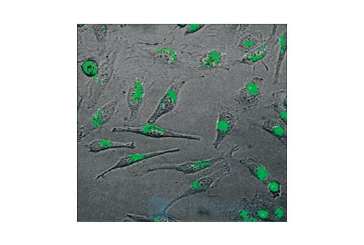 undefined Image 1: SignalSilence<sup>®</sup> Akt2 siRNA