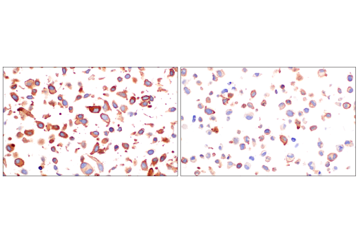 Immunohistochemistry Image 6: CD109 (E4I2V) Rabbit mAb